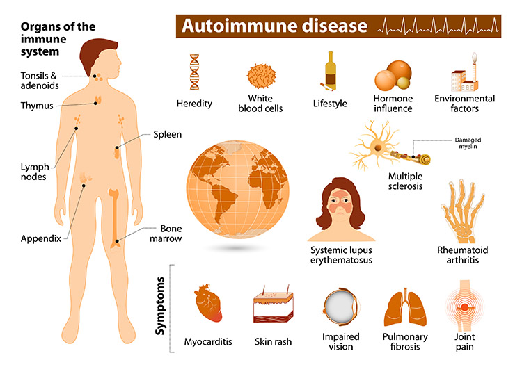 Immune-related disorders encompass a wide range of conditions where the immune system malfunctions, leading to either excessive immune responses, as seen in autoimmune diseases, or insufficient responses, such as in immunodeficiencies and cancer. Innovative immunotherapies, including CAR-T (Chimeric Antigen Receptor T-cell) therapy and NK-T (Natural Killer T-cell) therapy, have emerged as promising treatment options for various immune-related disorders, particularly in oncology.