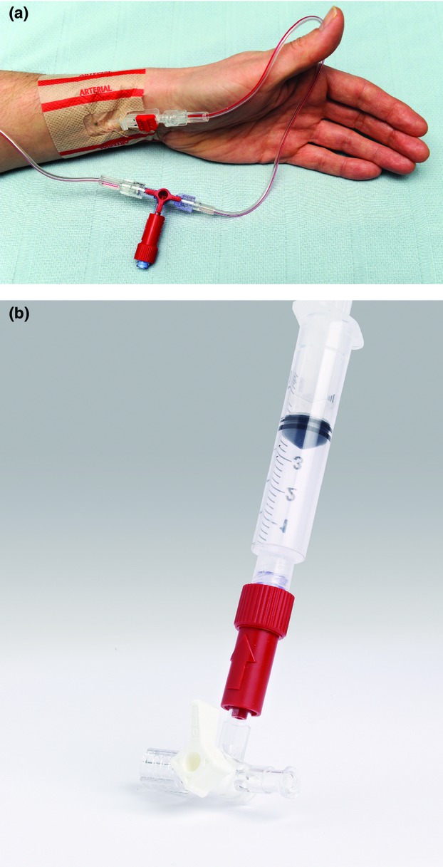 Intra-arterial injections are a specialized technique used at DrStemCellsThailand's Anti-Aging and Regenerative Medicine Center to deliver cellular therapy and stem cells directly into the arterial circulation. This method allows for targeted treatment of various conditions, particularly in the context of organ-specific therapies, such as those for renal diseases.