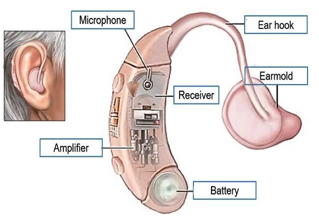 Hearing aids (HA) are small electronic devices designed to improve hearing by amplifying sound for individuals with hearing loss. They help users perceive sounds more clearly, facilitating better communication and enhancing overall quality of life.