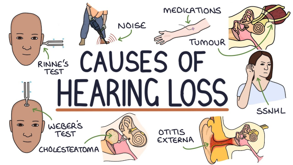 Hearing loss (HL) refers to a partial or total inability to hear sounds in one or both ears. It can be present at birth or acquired later in life, affecting individuals of all ages. Hearing loss can significantly impact communication and quality of life, leading to social isolation and emotional distress.