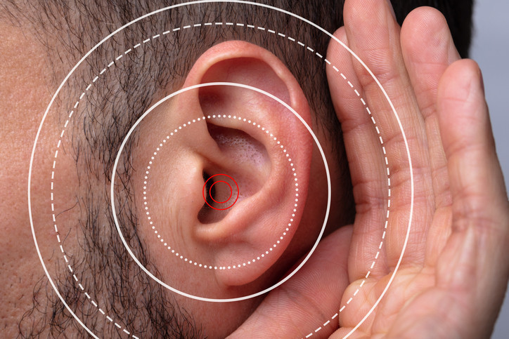 Hearing loss (HL) refers to a partial or total inability to hear sounds in one or both ears. It can be present at birth or acquired later in life, affecting individuals of all ages. Hearing loss can significantly impact communication and quality of life, leading to social isolation and emotional distress.