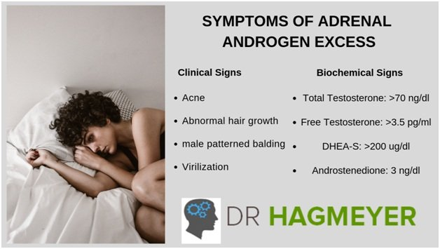 Androgen excess, also known as hyperandrogenism, refers to elevated levels of androgens, particularly testosterone, in the body. This condition is more common in women and can lead to various physical and hormonal changes. Androgen excess is often associated with disorders like polycystic ovary syndrome (PCOS), adrenal hyperplasia, and other endocrine abnormalities.