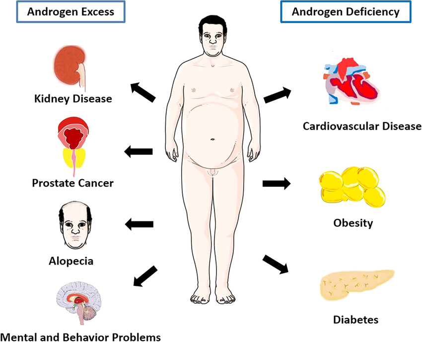 Androgen excess (AE), also known as hyperandrogenism, refers to elevated levels of androgens, particularly testosterone, in the body. This condition is more common in women and can lead to various physical and hormonal changes. Androgen excess is often associated with disorders like polycystic ovary syndrome (PCOS), adrenal hyperplasia, and other endocrine abnormalities.