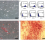 Mesenchymal stem cells (MSCs) have emerged as a promising therapeutic option for various fibrotic conditions, including those affecting the kidneys. Their anti-fibrotic properties are attributed to several mechanisms that promote tissue repair and modulate inflammatory responses. Understanding these effects is crucial for developing effective treatments for chronic kidney diseases and other fibrotic disorders.