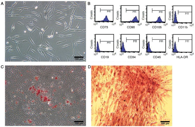 Mesenchymal stem cells (MSCs) have emerged as a promising therapeutic option for various fibrotic conditions, including those affecting the kidneys. Their anti-fibrotic properties are attributed to several mechanisms that promote tissue repair and modulate inflammatory responses. Understanding these effects is crucial for developing effective treatments for chronic kidney diseases and other fibrotic disorders.