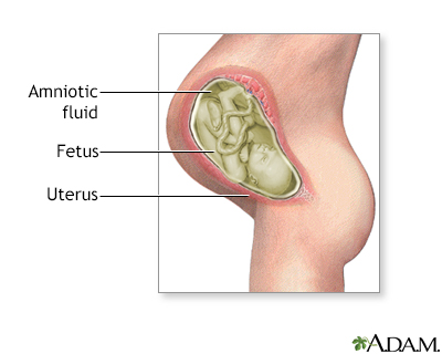 Amniotic fluid (AF) is a clear, slightly yellowish liquid that surrounds and protects the developing fetus during pregnancy. It is contained within the amniotic sac and plays several critical roles in fetal development.