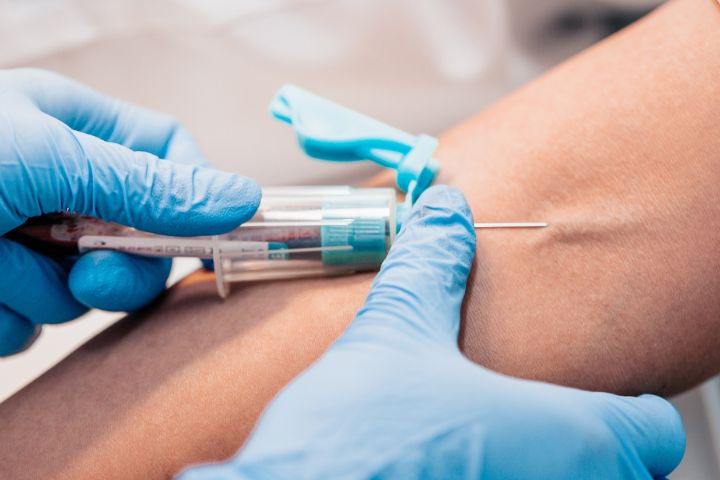 Phlebotomy, also known as venipuncture or blood draw, is the process of collecting blood from a vein, typically in the arm, for diagnostic testing or other medical purposes[1][4][7]. It is a critical skill performed by phlebotomists, nurses, medical lab scientists, and other healthcare workers[1][4].