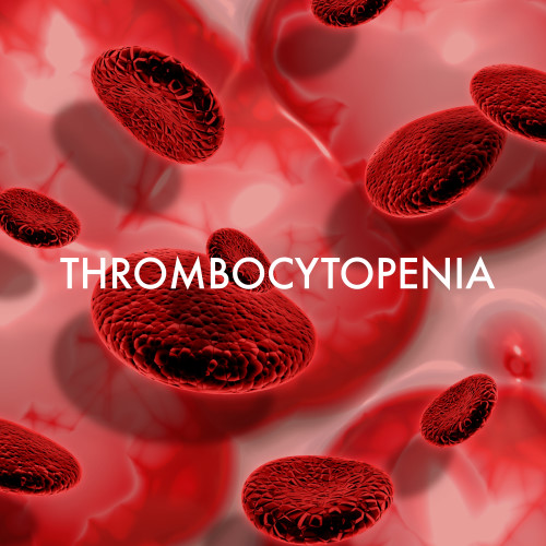 Thrombocytopenia is a medical condition characterized by a lower-than-normal number of platelets (thrombocytes) in the blood. Platelets are essential for blood clotting, as they help form clots to stop bleeding. A low platelet count can lead to easy bruising, prolonged bleeding from cuts, and increased risk of internal bleeding.