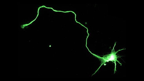 Neuroregeneration refers to the process by which the nervous system repairs or regrows damaged tissues, cells, or cell products. This includes the generation of new neurons, glial cells, axons, myelin, and synapses. Neuroregenerative mechanisms vary significantly between the peripheral nervous system (PNS) and the central nervous system (CNS), particularly regarding the extent and speed of repair. While the PNS exhibits a remarkable ability to regenerate after injury, the CNS has limited self-repair capabilities.