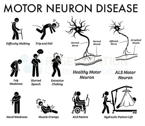 Motor neurons (MNs) are specialized nerve cells responsible for transmitting signals from the central nervous system (CNS) to muscles and glands throughout the body. They play a crucial role in controlling voluntary and involuntary movements, allowing for actions such as walking, speaking, and reflex responses.