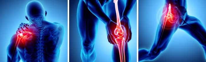 Pain is a complex and multifaceted experience that can significantly impact an individual's quality of life. It serves as a critical warning signal for the body, indicating injury or illness. Pain conditions can be categorized based on duration, underlying causes, and the nature of the pain experienced. Below is an overview of various pain conditions, their classifications, and implications for management.