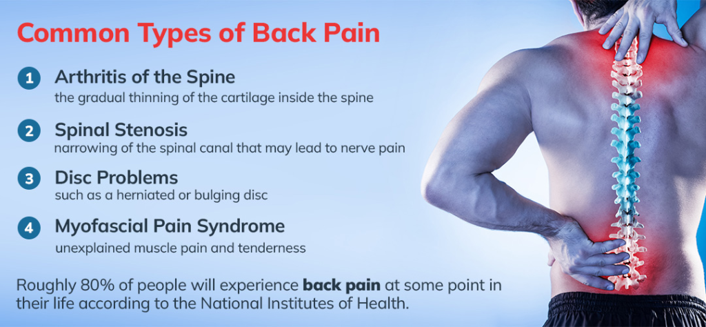 Chronic back pain is a prevalent condition that affects millions of people worldwide. It is defined as pain that persists for more than three months and can significantly impact an individual's quality of life. Understanding the causes, symptoms, and management options is essential for effectively addressing chronic back pain.