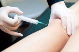 Intra-articular injection (IAI) of cellular therapy and stem cells is a treatment for knee osteoarthritis that aims to relieve pain, improve motor function, and stimulate cartilage regeneration34.