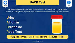 The Urinary Albumin-to-Creatinine Ratio (UACR) is a critical marker used to diagnose and monitor kidney disease, particularly in patients with diabetes. It measures the amount of albumin (a protein) in relation to creatinine in urine, providing insights into kidney damage and function.