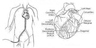 Heart catheterization, also known as cardiac catheterization, is a medical procedure used to diagnose and treat certain heart conditions. It involves inserting a thin, flexible tube called a catheter into a blood vessel in the arm, neck, or groin and guiding it to the heart. This procedure allows healthcare providers to visualize the heart's chambers, valves, and major blood vessels, assess blood flow, and identify any blockages or abnormalities.