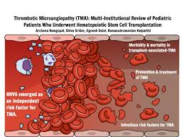 Thrombotic microangiopathy (TMA) is a pathological condition characterized by thrombosis in capillaries and arterioles due to endothelial injury1. This leads to microangiopathic hemolytic anemia, thrombocytopenia, and ischemic tissue injury4. TMAs are rare but life-threatening and require urgent management47.