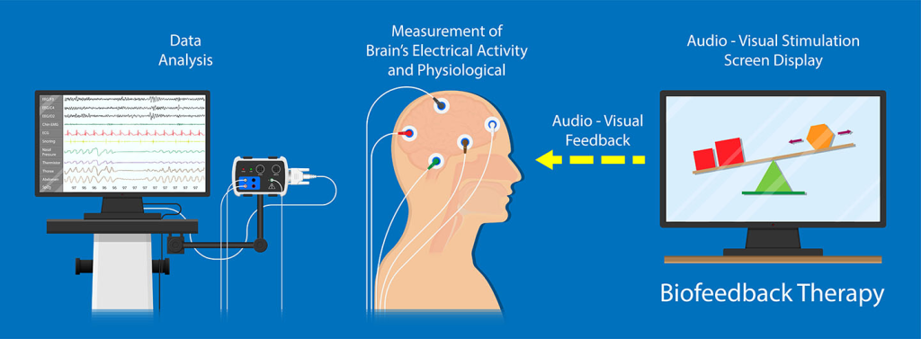 Neurofeedback is a type of biofeedback that uses real-time displays of brain activity to teach self-regulation of brain function134. It is a non-invasive neurotherapy that collects brain activity data using electroencephalography (EEG)2. Neurofeedback is not considered a cure, but a method of managing and regulating the brain to promote healthier functioning8.