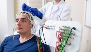 Electroencephalography (EEG) is a neurophysiological technique used to record the brain's spontaneous electrical activity156. During the procedure, small metal discs with thin wires, known as electrodes, are placed on the scalp to detect and record tiny electrical charges resulting from the activity of brain cells34. The EEG is typically non-invasive, and the electrodes are positioned using the International 10-20 system or its variations1. The electrical activity is amplified and displayed as a graph on a computer screen or printed on paper, which is then interpreted by a healthcare provider4.