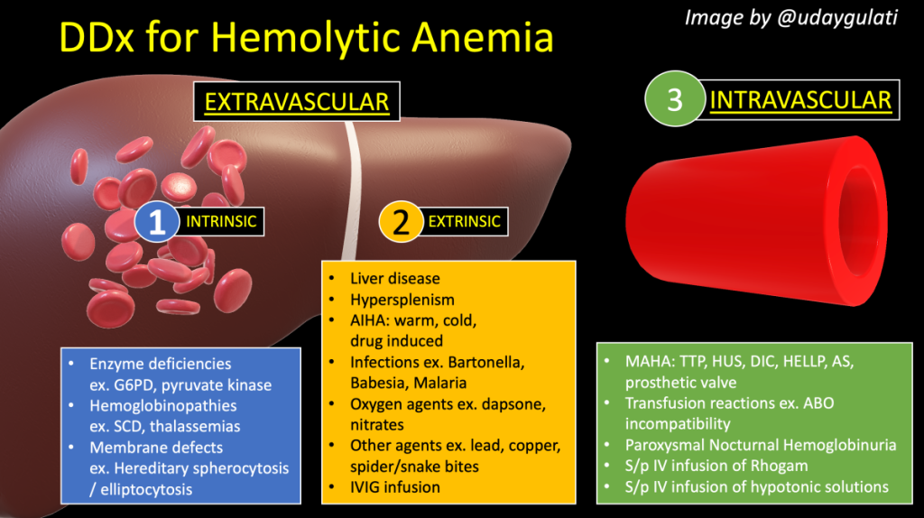 Hemolytic anemia (HA) is a condition in which red blood cells (RBCs) are destroyed faster than the body can replace them, leading to a deficiency of healthy red blood cells and hemoglobin, which are crucial for oxygen delivery throughout the body158. The destruction of red blood cells is called hemolysis134. Hemolytic anemia accounts for 5% of all existing anemias1. It can be acquired or inherited, and the severity and duration can vary34.