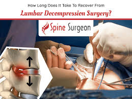 Surgical decompression is a procedure used to relieve pressure on the spinal cord or nerves caused by conditions such as spinal stenosis, herniated discs, or bone spurs. It involves removing or modifying bone, discs, or soft tissues to create space and alleviate symptoms like pain, numbness, or weakness.