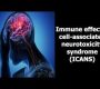 Immune Effector Cell-Associated Neurotoxicity Syndrome (ICANS) is a potentially life-threatening neurotoxicity that commonly occurs as a complication of immune effector cell therapies, particularly chimeric antigen receptor (CAR) T-cell therapy used for hematological malignancies. It manifests as a spectrum of neurological symptoms caused by immune-mediated inflammation affecting the central nervous system (CNS).