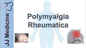 Polymyalgia rheumatica (PR) is an inflammatory condition characterized by muscle pain and stiffness, primarily affecting the shoulders, hips, neck, and upper arms. It most commonly occurs in people over the age of 65 and rarely affects those under 50. Symptoms often develop quickly, over days to weeks, and are typically worse in the morning or after periods of inactivity.