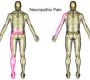 Neuropathic pain (NP) is a complex, chronic pain condition that arises from damage or disease affecting the somatosensory nervous system, which includes peripheral nerves, the spinal cord, and the brain128. Unlike nociceptive pain, which results from tissue injury, neuropathic pain is due to abnormal processing of pain signals by the nervous system itself.