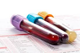 C-terminal telopeptide (CTX-I) is a peptide fragment released during the breakdown of type I collagen, a major component of bone. It serves as a biomarker for bone resorption, reflecting osteoclast activity and bone turnover rates.