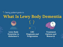 Lewy body dementia (LBD) is the second most common type of progressive dementia after Alzheimer’s disease. It is caused by abnormal deposits of a protein called alpha-synuclein (Lewy bodies) in brain cells, affecting regions involved in thinking, memory, movement, and autonomic functions16.