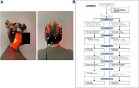 Transcranial near-infrared therapy (tNIR), also known as transcranial photobiomodulation (tPBM), is a noninvasive brain stimulation technique that uses low-level near-infrared (NIR) light to penetrate the scalp and skull, modulating brain function at cellular and systemic levels. It has shown promise in treating neurodegenerative diseases, traumatic brain injury, and cognitive disorders by enhancing mitochondrial function, reducing inflammation, and promoting neuroprotection.