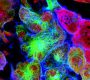 Cancer stem cells (CSCs) are a small, distinct subpopulation of cells within tumors that possess stem cell-like properties, notably the abilities to self-renew and to differentiate into the heterogeneous cell types that comprise the tumor mass938. First identified in acute myeloid leukemia and later in solid tumors, CSCs are now recognized in a wide range of cancers, including prostate cancer (PCa), breast, colorectal, and brain tumors93.