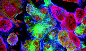 Cancer stem cells (CSCs) are a small, distinct subpopulation of cells within tumors that possess stem cell-like properties, notably the abilities to self-renew and to differentiate into the heterogeneous cell types that comprise the tumor mass938. First identified in acute myeloid leukemia and later in solid tumors, CSCs are now recognized in a wide range of cancers, including prostate cancer (PCa), breast, colorectal, and brain tumors93.