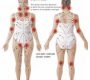 Lymphatic Drainage Therapy (LDT), also known as Manual Lymphatic Drainage (MLD), is a specialized, gentle massage technique aimed at stimulating the lymphatic system to enhance lymph fluid circulation, reduce swelling (edema), and support the body’s natural detoxification and immune processes.