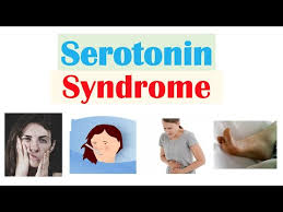 Serotonin syndrome is a potentially life-threatening condition caused by excessive accumulation of serotonin in the nervous system, typically due to the use or interaction of serotonergic drugs. It can range from mild symptoms like shivering and diarrhea to severe manifestations such as muscle rigidity, high fever, seizures, and even death if untreated16.