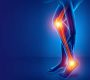 Nerve Entrapment Syndromes (NES), also known as nerve compression syndromes or entrapment neuropathies, occur when a peripheral nerve is chronically compressed or trapped by surrounding tissues such as ligaments, muscles, or bones. This compression impairs the nerve’s ability to transmit signals, leading to a range of sensory and motor symptoms localized to the nerve’s distribution area.