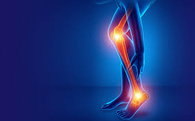 Nerve Entrapment Syndromes (NES), also known as nerve compression syndromes or entrapment neuropathies, occur when a peripheral nerve is chronically compressed or trapped by surrounding tissues such as ligaments, muscles, or bones. This compression impairs the nerve’s ability to transmit signals, leading to a range of sensory and motor symptoms localized to the nerve’s distribution area.