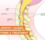 Myelopathy refers to spinal cord compression that leads to neurological deficits. When this compression occurs in the cervical spine (neck region), it is called cervical myelopathy, the most common type of myelopathy. It results from narrowing of the spinal canal, which puts pressure on the spinal cord, impairing nerve signal transmission to and from the brain.