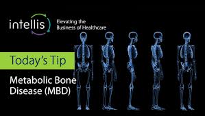 Metabolic bone diseases (MBD) are a group of disorders characterized by abnormal bone strength, structure, or mass due to imbalances in minerals (calcium, phosphorus), hormones (parathyroid hormone, vitamin D), or genetic factors. These conditions disrupt bone remodeling, leading to weakened bones, fractures, deformities, and systemic complications.