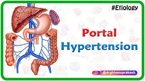 Portal Hypertension (PoTaH) is an abnormal increase in blood pressure within the portal venous system, which includes the portal vein and its branches that carry blood from the stomach, intestines, spleen, and pancreas to the liver. Normally, blood flows smoothly through the liver, but when this flow is obstructed, pressure builds up in the portal vein system.