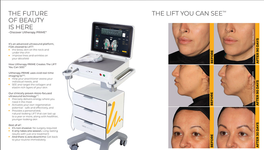 Ultherapy (HIFU – High-Intensity Focused Ultrasound)