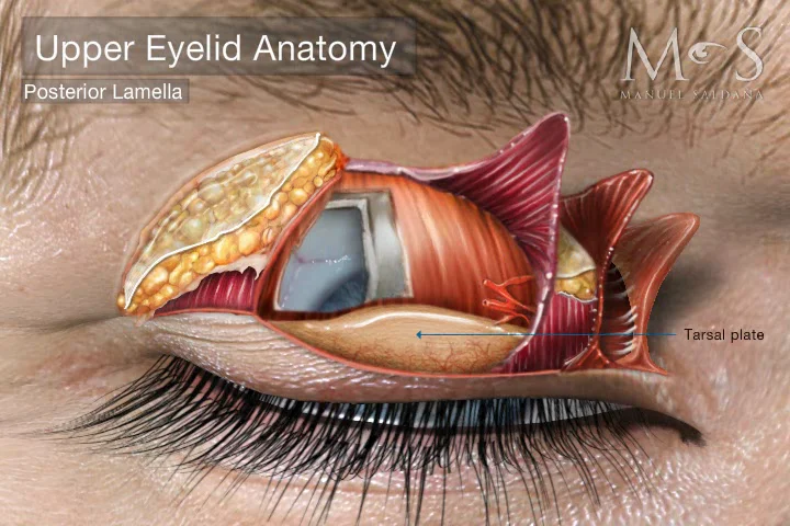 Advanced Eye Cosmetic Surgery : Upper Eyelid Enhancements