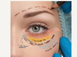 Advanced Eye Cosmetic Surgery :  Lower Eyelid Enhancements