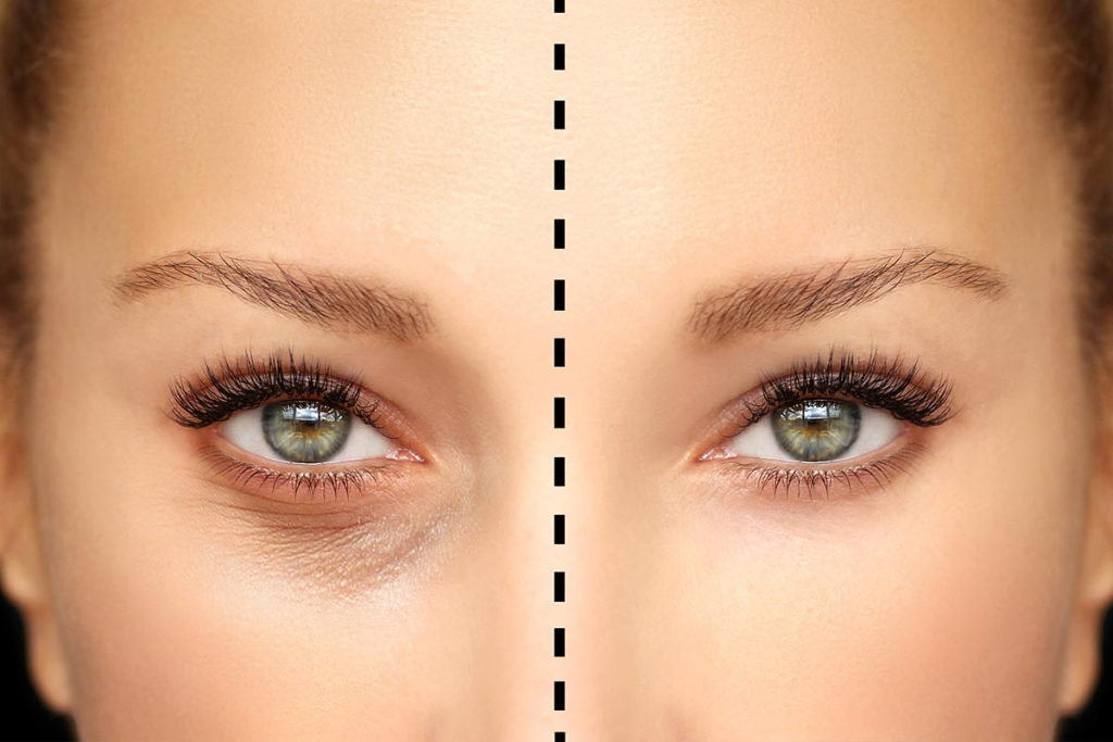 Advanced Eye Cosmetic Surgery :  Revision & Functional Reconstruction
