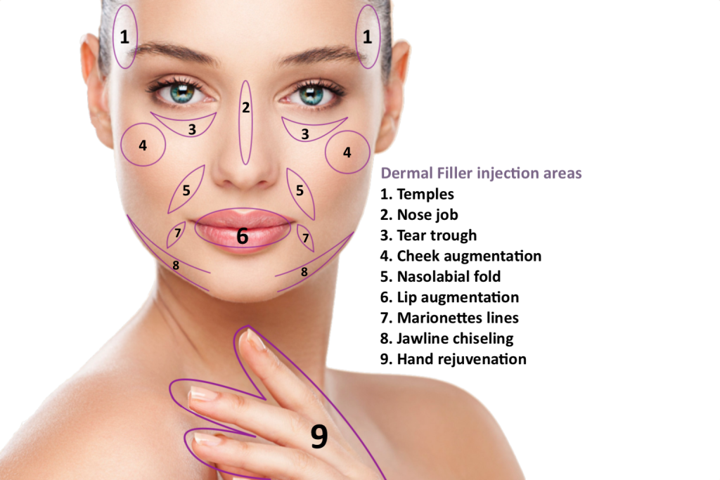 Facial Contouring Surgery  : Dermal Fillers (Hyaluronic Acid, Calcium Hydroxylapatite)