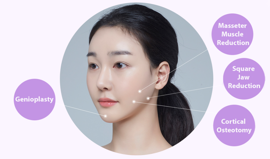 Facial Contouring Surgery at PASCAL, KCCS