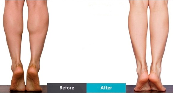 Skin Care & Laser Dermatology :  Body Botox: Reduces sweating or reshapes bulky calf/shoulder muscles.