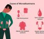 Microalbuminuria is the presence of a small amount of the protein albumin in the urine, which is higher than normal but below the level detectable by routine urine tests. It indicates early kidney damage when the kidneys’ filtering units (glomeruli) become slightly permeable and allow albumin to leak into the urine. This condition is an important early warning sign of chronic kidney disease, particularly in people with diabetes or hypertension123.
