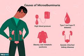 Microalbuminuria is the presence of a small amount of the protein albumin in the urine, which is higher than normal but below the level detectable by routine urine tests. It indicates early kidney damage when the kidneys’ filtering units (glomeruli) become slightly permeable and allow albumin to leak into the urine. This condition is an important early warning sign of chronic kidney disease, particularly in people with diabetes or hypertension123.