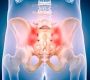 The sacroiliac (SI) joints are paired synovial joints that connect the sacrum—the triangular bone at the base of the spine—to the ilium bones of the pelvis. Positioned deep in the pelvis on either side of the lower spine, these joints play a vital role in transmitting forces between the upper body and the lower limbs.