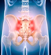 The sacroiliac (SI) joints are paired synovial joints that connect the sacrum—the triangular bone at the base of the spine—to the ilium bones of the pelvis. Positioned deep in the pelvis on either side of the lower spine, these joints play a vital role in transmitting forces between the upper body and the lower limbs.